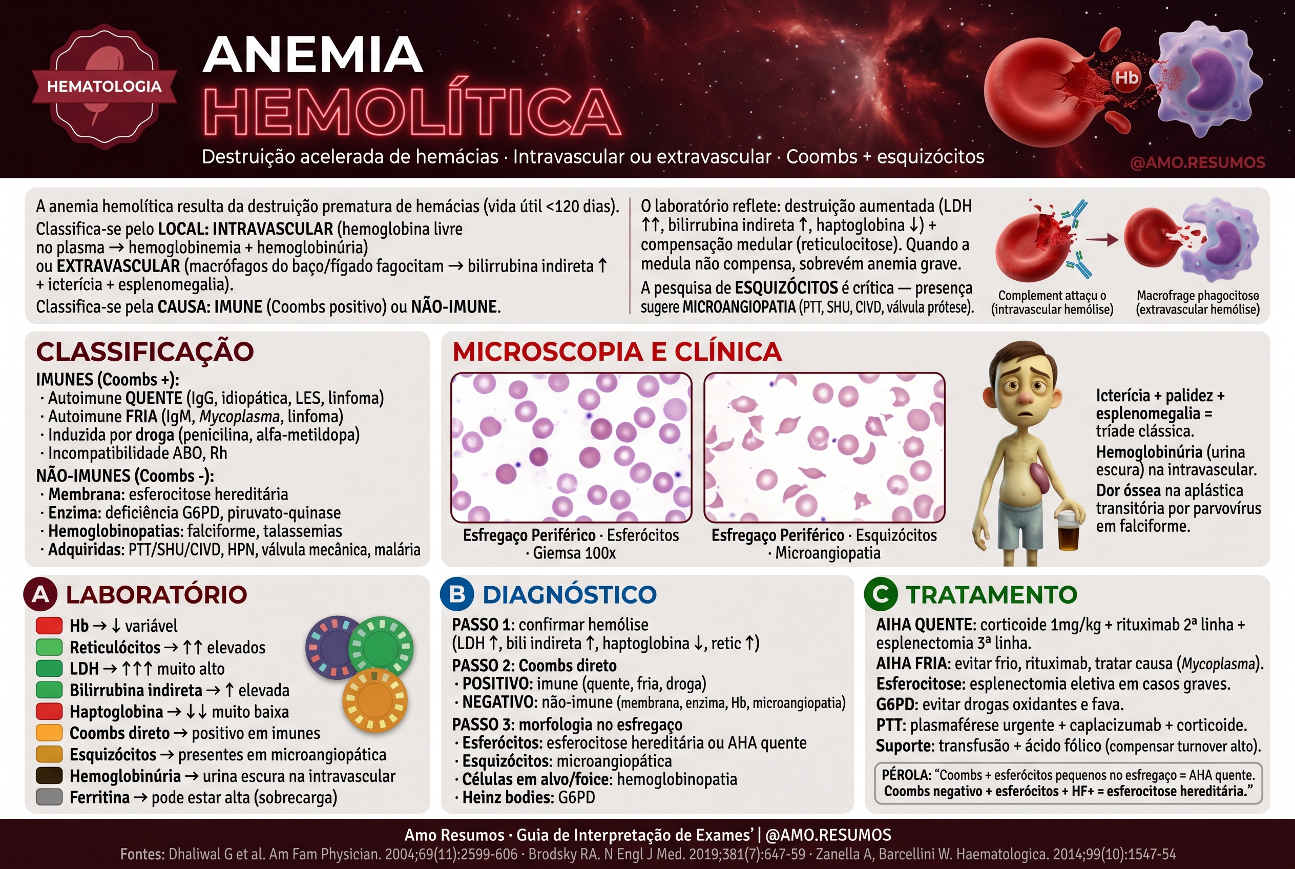 Anemia Hemolítica