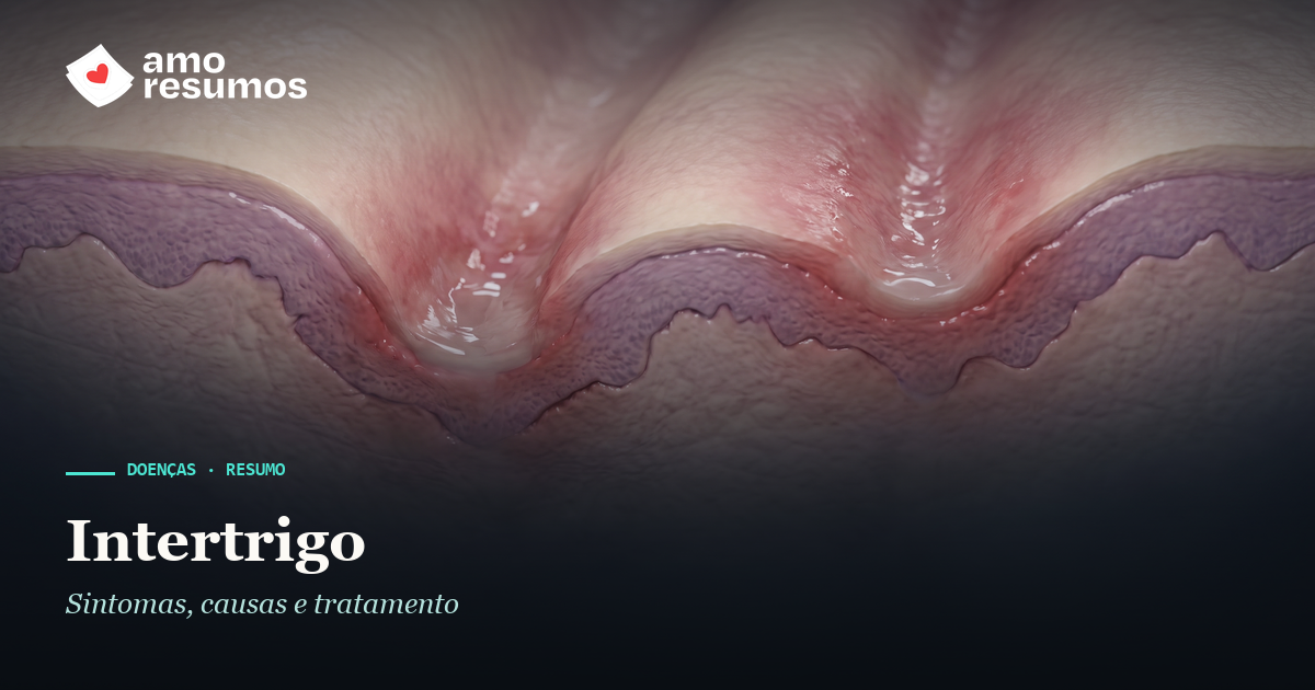 Intertrigo — ilustração — Amo Resumos