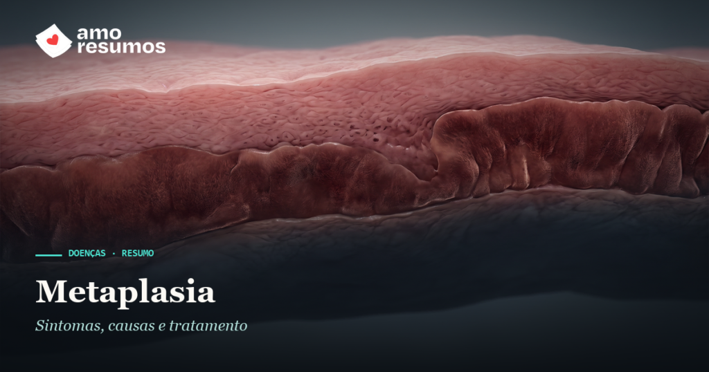 Metaplasia — ilustração — Amo Resumos