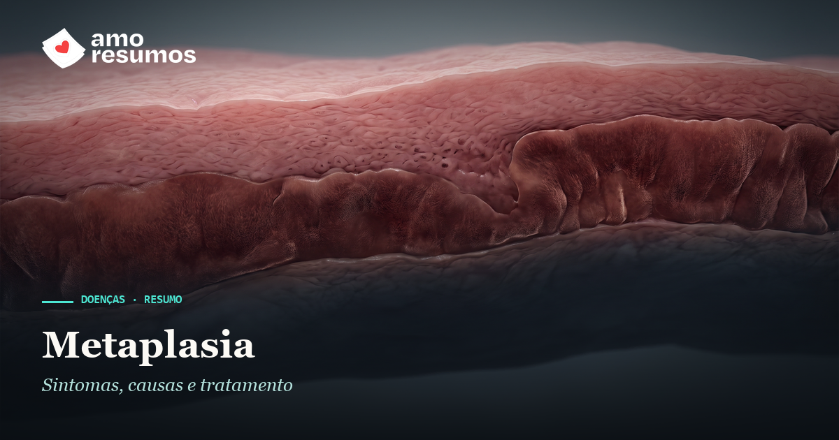 Metaplasia — ilustração — Amo Resumos