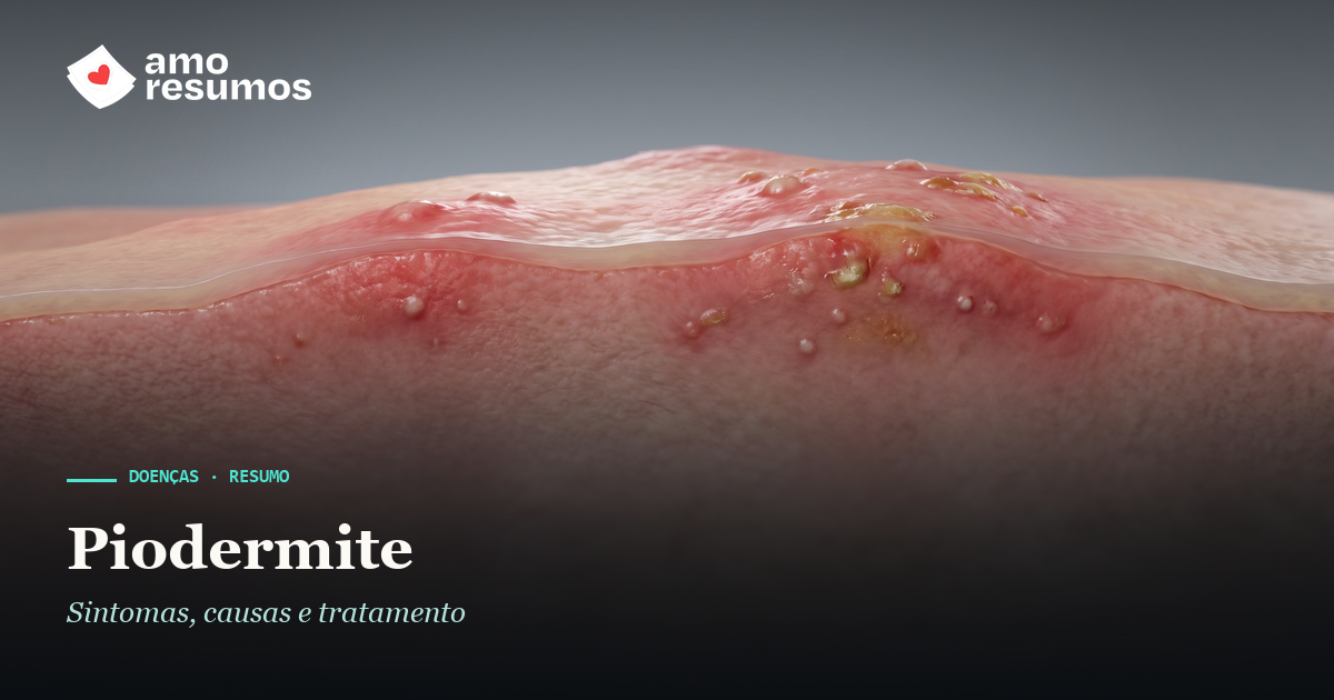 Piodermite — ilustração — Amo Resumos