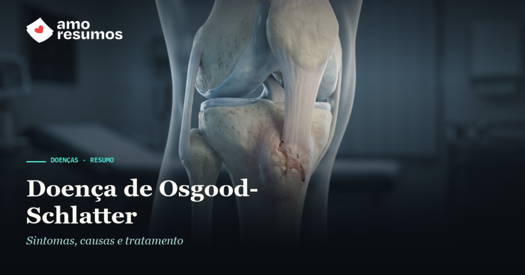 Doença de Osgood-Schlatter — ilustração — Amo Resumos