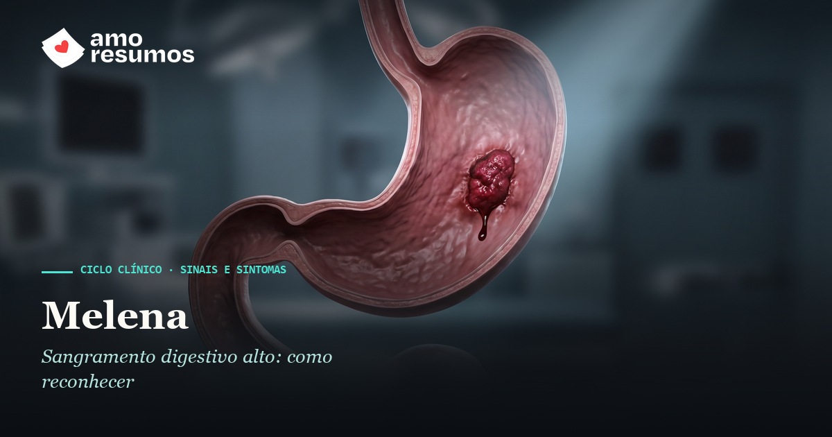 Melena: sangramento digestivo alto — ilustração — Amo Resumos