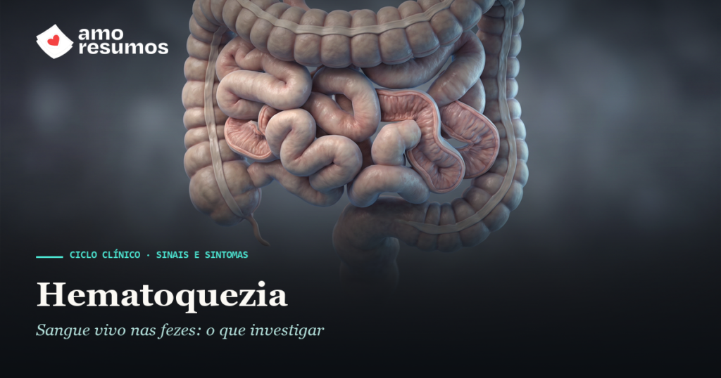 Hematoquezia: sangramento digestivo baixo — ilustração — Amo Resumos