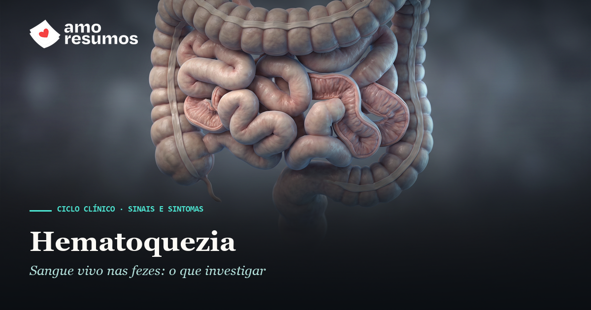 Hematoquezia: sangramento digestivo baixo — ilustração — Amo Resumos