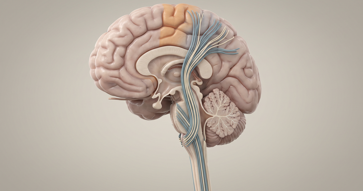 Via motora e hemiparesia contralateral no AVC — Amo Resumos