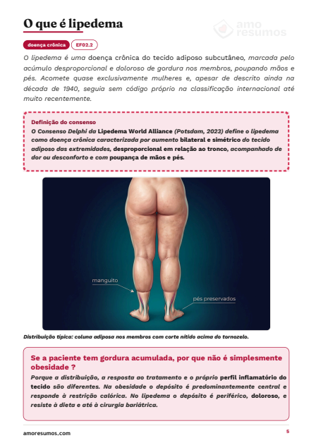 O que é lipedema — definição de consenso