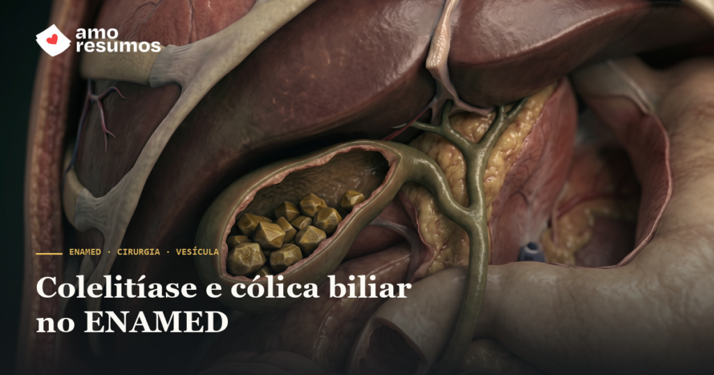 Colelitíase e cólica biliar no ENAMED: quando o cálculo dói — Amo Resumos