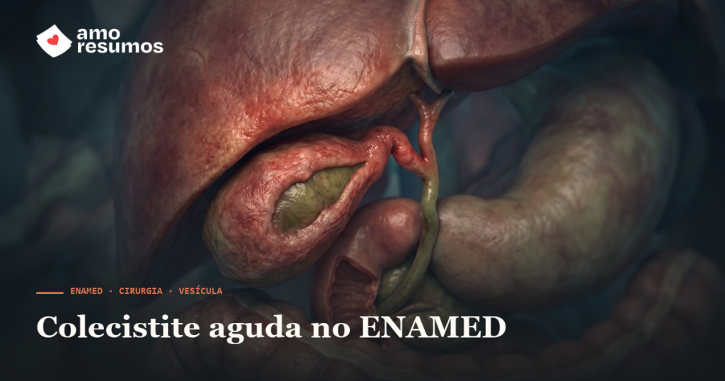 Colecistite aguda no ENAMED: sinal de Murphy e conduta — Amo Resumos