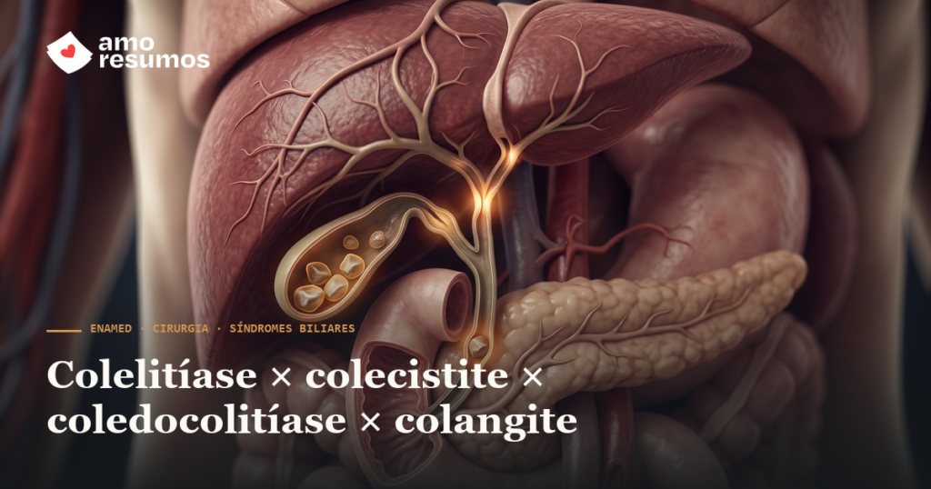 Colelitíase × colecistite × coledocolitíase × colangite: o comparativo do ENAMED — Amo Resumos