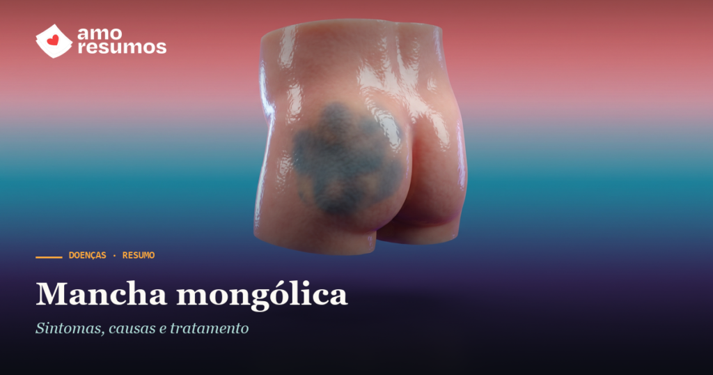 Mancha mongólica — ilustração — Amo Resumos