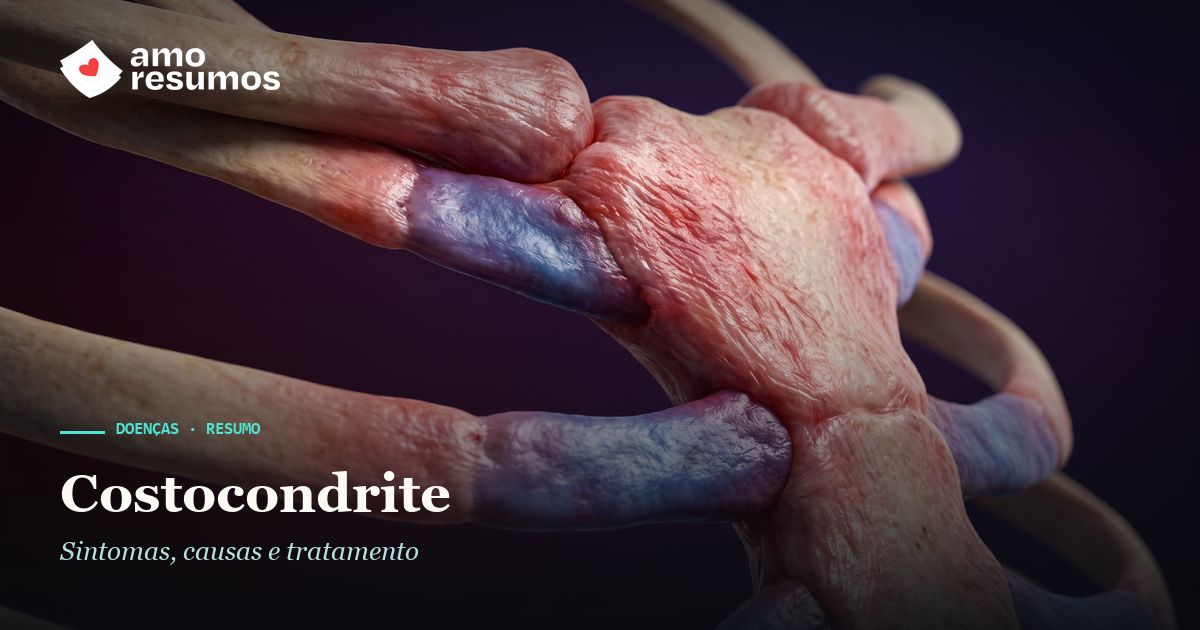 Costocondrite — ilustração — Amo Resumos