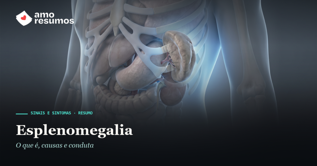 Esplenomegalia — ilustração — Amo Resumos