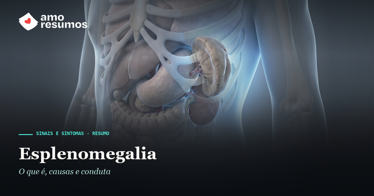 Esplenomegalia — ilustração — Amo Resumos