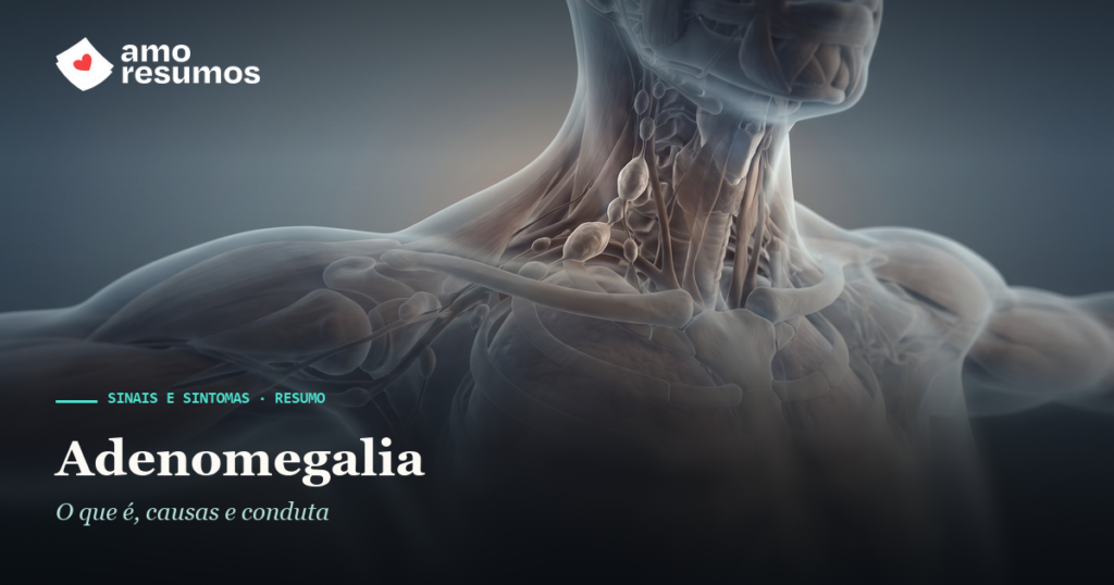 Adenomegalia — ilustração — Amo Resumos