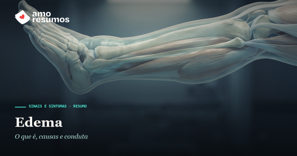 Edema — ilustração — Amo Resumos