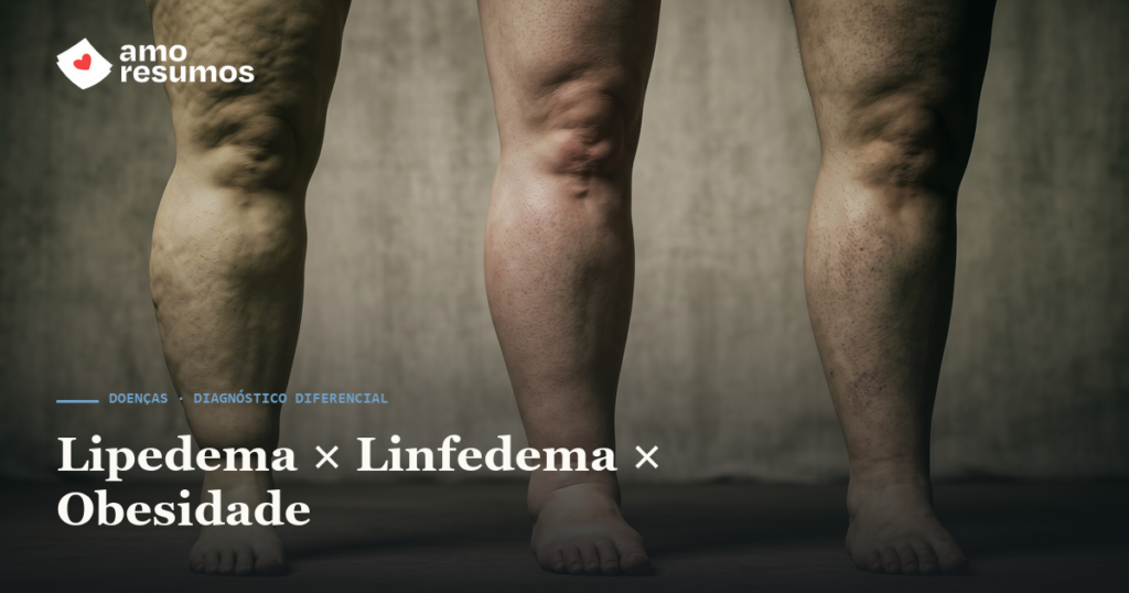 Lipedema × Linfedema × Obesidade: como diferenciar — Amo Resumos