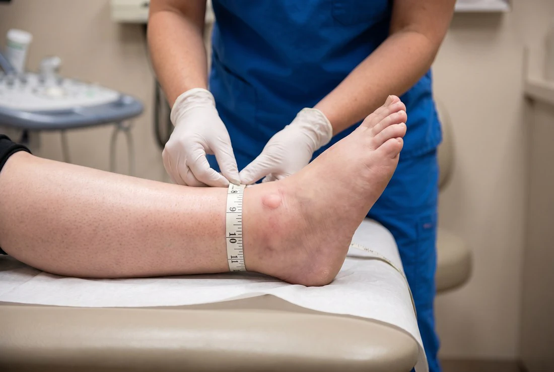 Ficha de exame do edema, passo a passo