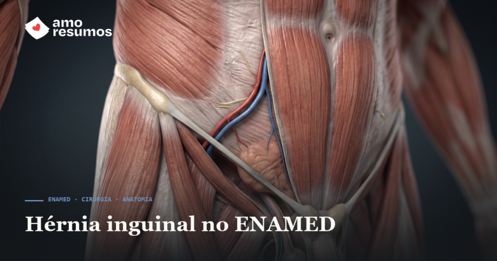 Hérnia inguinal no ENAMED: direta × indireta e o trígono de Hesselbach — Amo Resumos