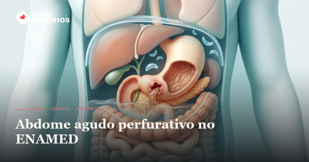 Abdome agudo perfurativo no ENAMED: úlcera, pneumoperitônio e abdome em tábua — Amo Resumos
