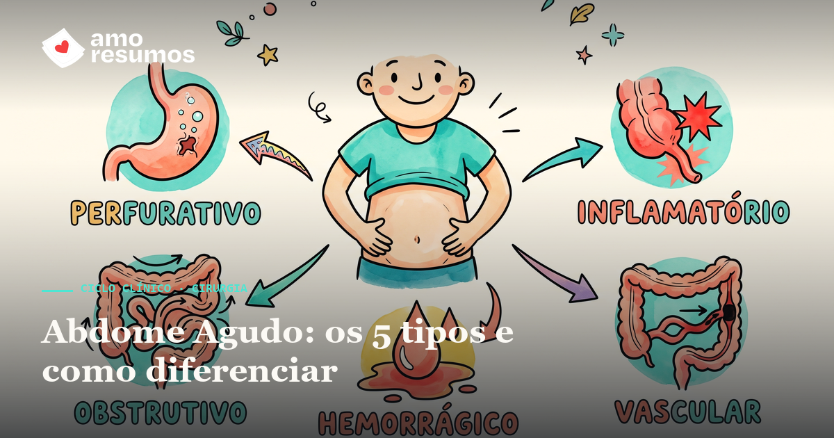 Abdome agudo — os 5 tipos e como diferenciar — ilustração hand-draw — Amo Resumos